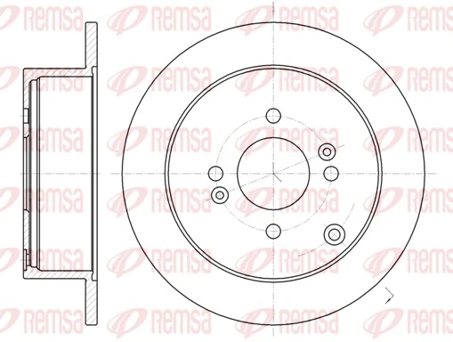 Remsa 6102400